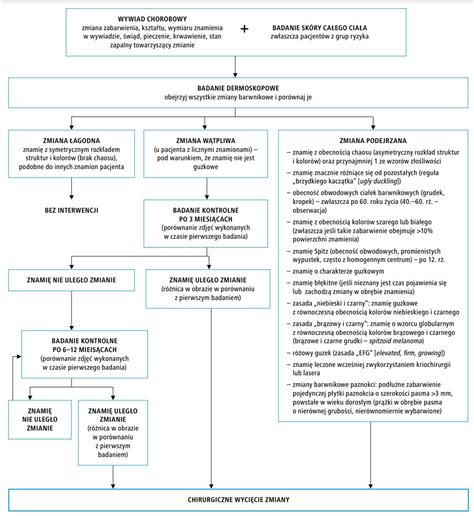 Schemat postępowania przy skardze na czynności komornicze