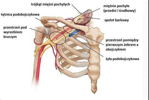 Schemat budowy klatki piersiowej z zaznaczoną deformacją pectus excavatum